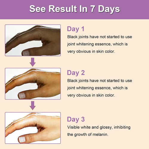 Dark Knuckle Whitening Serum 30ml Each (Pack of 2 )