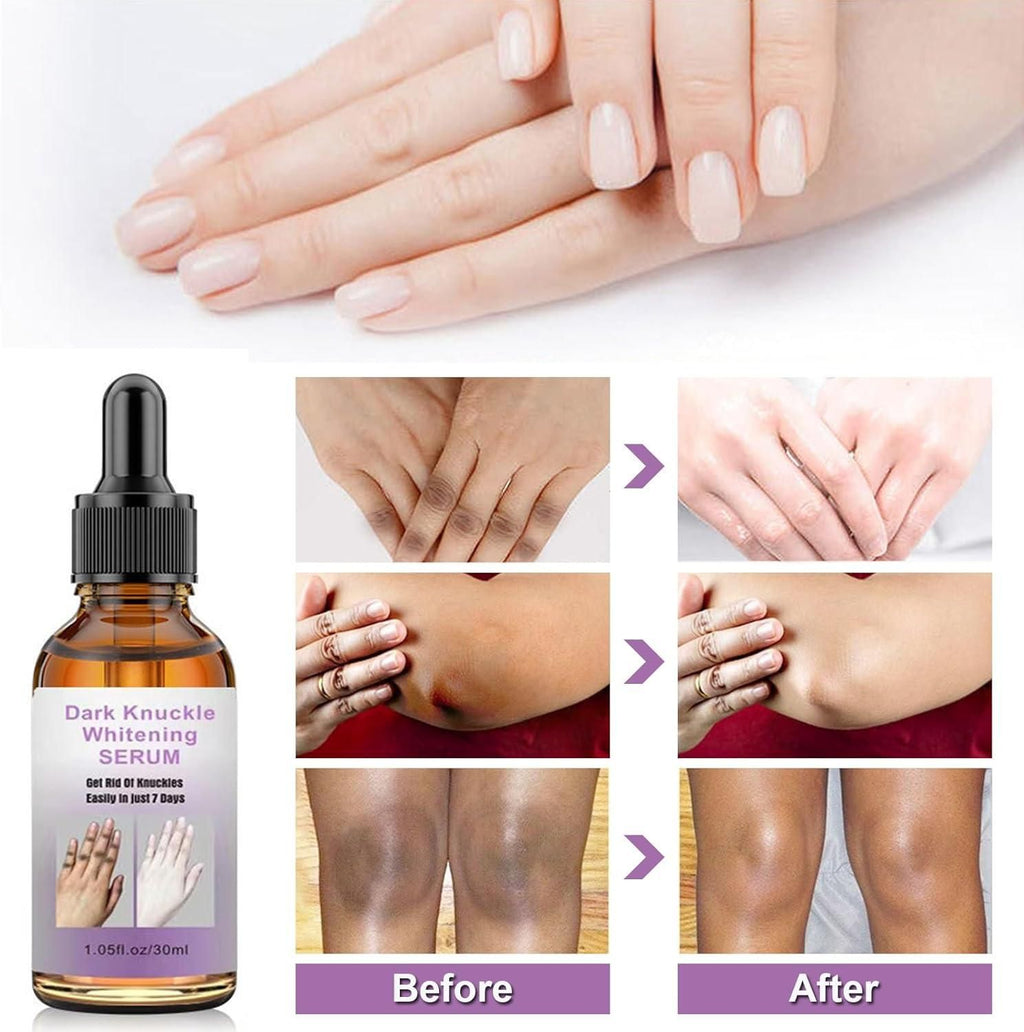 Dark Knuckle Whitening Serum 30ml Each (Pack of 2 )