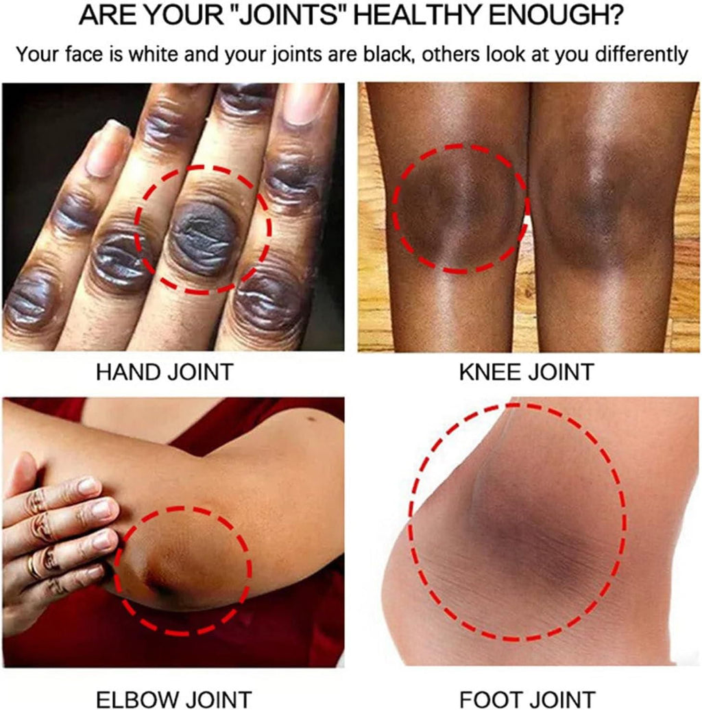 Dark Knuckle Whitening Serum 30ml Each (Pack of 2 )